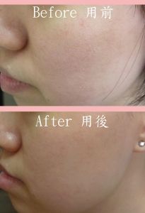 試用者 (1) Y 小姐